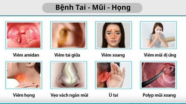 [Tổng hợp] Các bệnh tai mũi họng phổ biến hiện nay