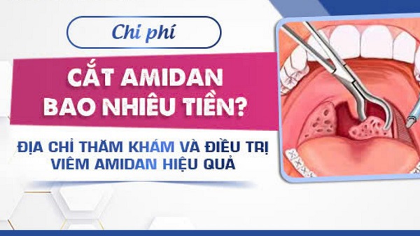 [BẢNG GIÁ 2026] Cắt viêm amidan bao nhiêu tiền?