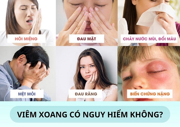 [Hỏi – đáp cùng chuyên gia] Mổ xoang có khỏi hẳn không?