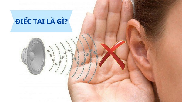 Tìm hiểu về dấu hiệu bị điếc tai – Nhận biết chính xác để điều trị cho đúng!