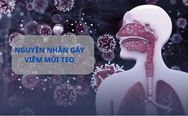 Bệnh viêm mũi teo – Hiểu chính xác, điều trị hiệu quả!