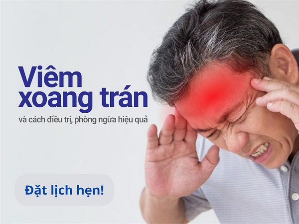Bác sĩ chuyên khoa chia sẻ cách điều trị viêm xoang trán HIỆU QUẢ – HẠN CHẾ TÁI PHÁT