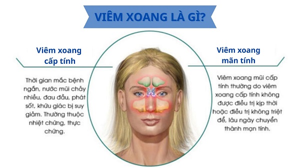 6 Bí Quyết Chữa Viêm Xoang Tại Nhà: Dễ Làm, Hiệu Quả Bất Ngờ