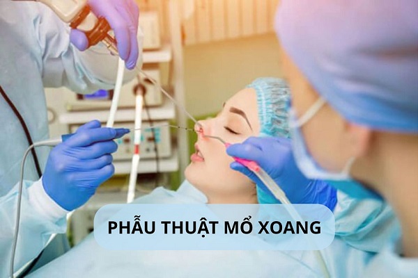 Bạn đang tìm kiếm phòng khám mổ xoang uy tín? – Tham khảo ngay địa chỉ trong bài viết này
