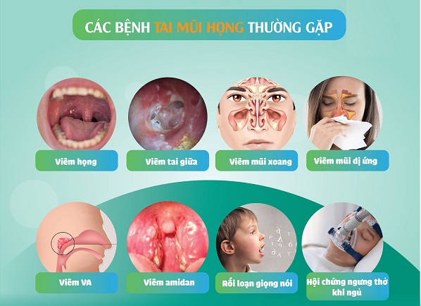 Điều trị tai mũi họng tại nhà hay phòng khám – Cách nào tốt hơn?